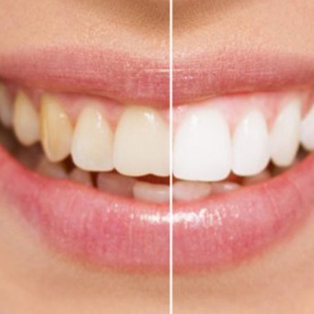 amo-odontologia-dentistica-estetica-1