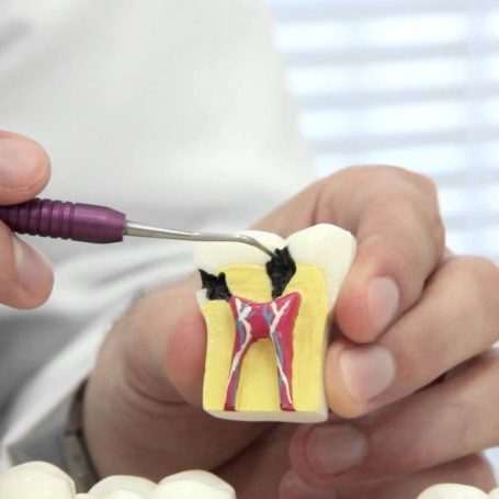 amo-odontologia-endodontia-e1512396803509