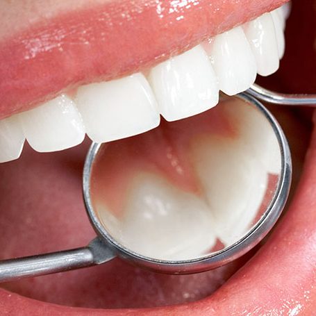 amo odonto periodontia-nov